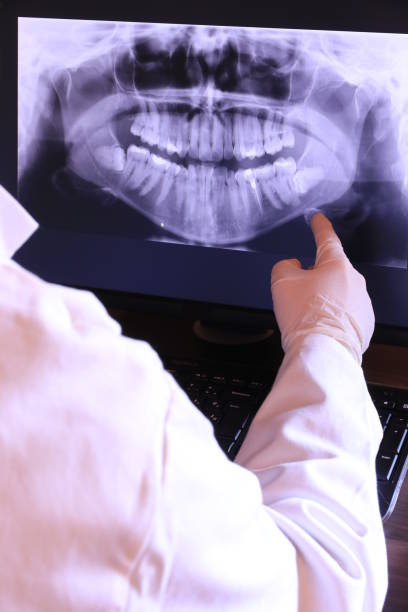Best Emergency Tooth Extraction  in Venersborg, WA